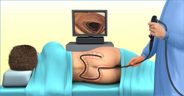 How much does Colonoscopy and Endoscopy cost in a private hospital